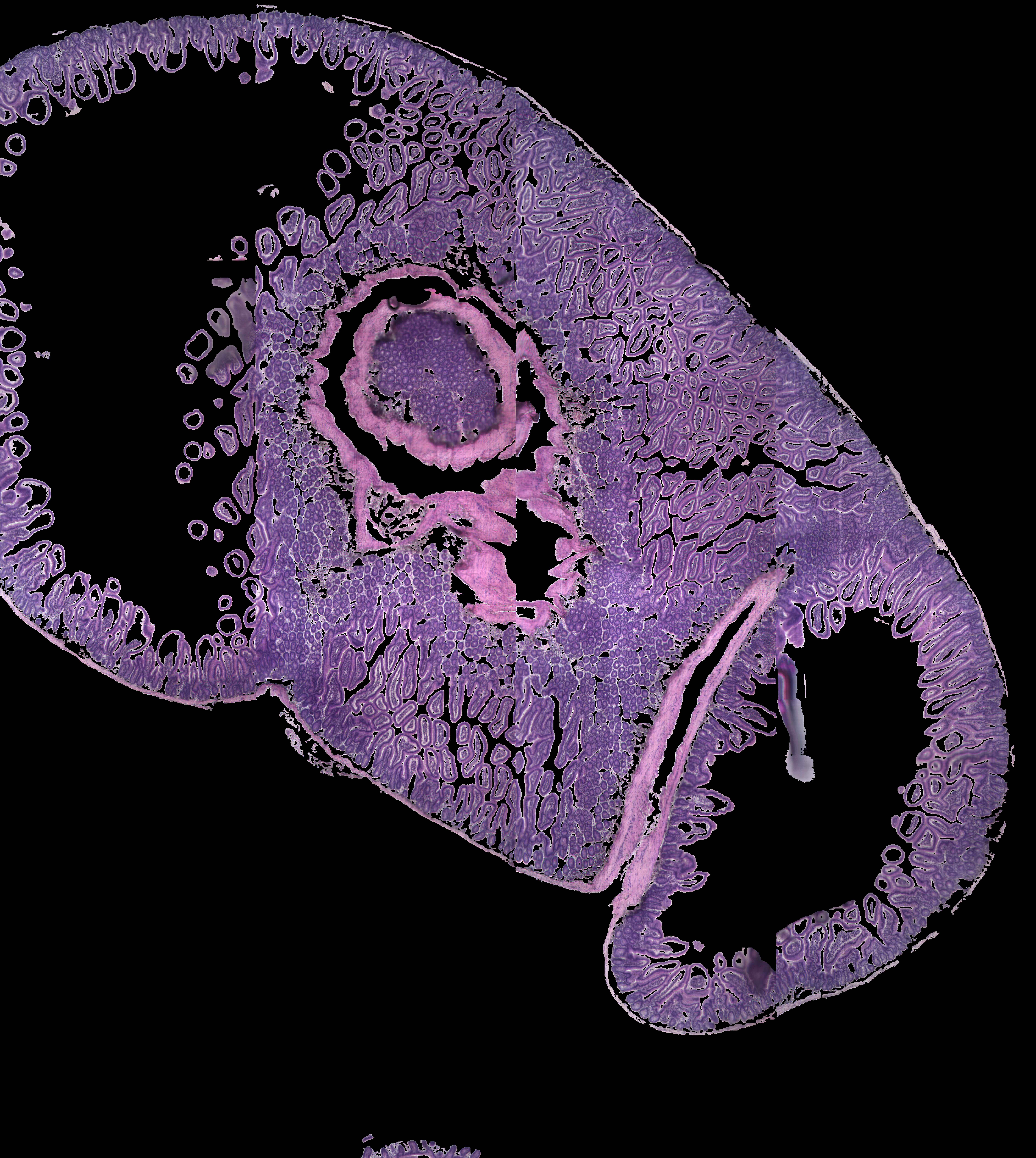 Still image of KESM data (H&E stained mouse gut) -1